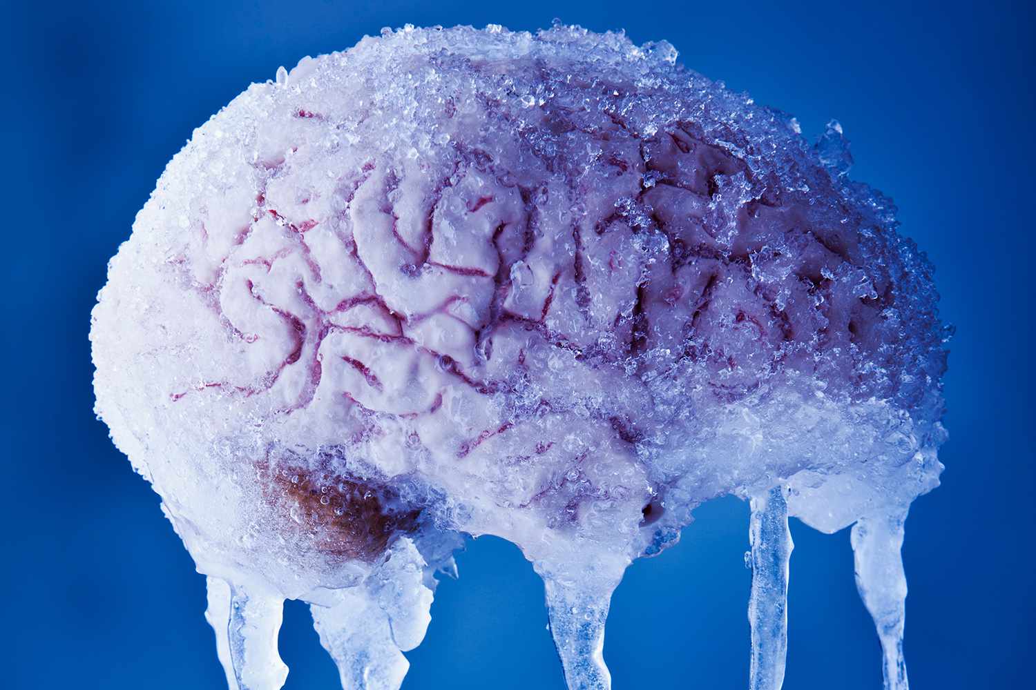 A person eating ice cream and wincing from brain freeze