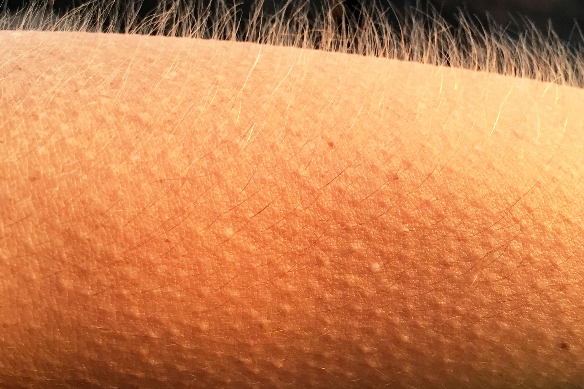 Why Do We Get Goosebumps?